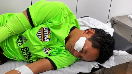 VIOLÊNCIA NO FUTEBOL: ÁRBITRA BONFINENSE É AGREDIDA DURANTE COPA RURAL