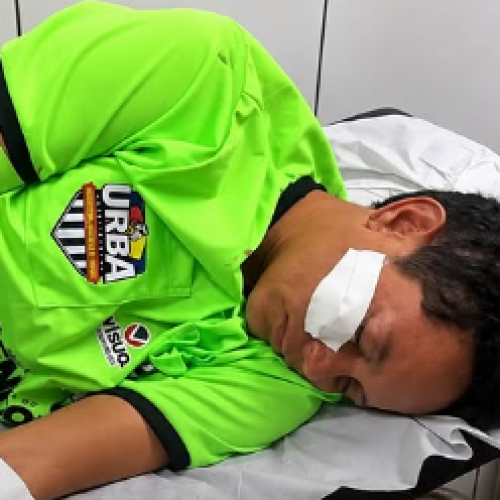 VIOLÊNCIA NO FUTEBOL: ÁRBITRA BONFINENSE É AGREDIDA DURANTE COPA RURAL